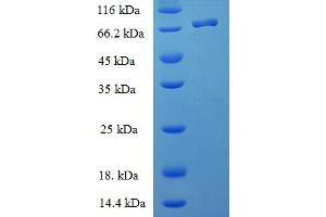 SDS-PAGE (SDS) image for BCL2-Associated Athanogene 5 (BAG5) (AA 1-447), (full length) protein (His-SUMO Tag) (ABIN4975789)