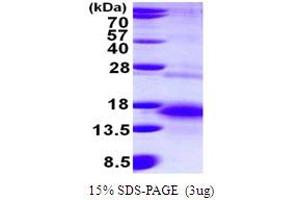 SDS-PAGE (SDS) image for Betacellulin (BTC) (AA 32-111) protein (His tag) (ABIN667960) (Betacellulin Protein (BTC) (AA 32-111) (His tag))