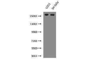 Western Blot Positive WB detected in: U251 whole cell lysate, SH-SY5Y whole cell lysate All lanes: NES antibody at 3 μg/mL Secondary Goat polyclonal to Mouse IgG at 1/10000 dilution Predicted band size: 178 kDa Observed band size: 260 kDa (Nestin antibody)