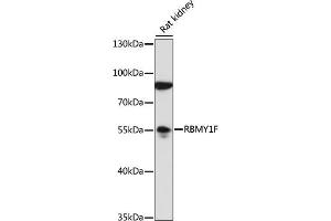 Western blot analysis of extracts of rat kidney, using RBMY1F antibody (ABIN7270095) at 1:1000 dilution. (RBMY1F antibody  (AA 1-80))