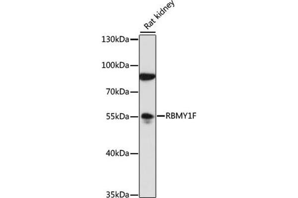 RBMY1F anticorps  (AA 1-80)