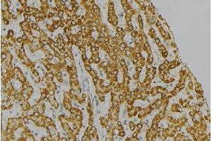 ABIN6274679 at 1/100 staining Mouse liver tissue by IHC-P.