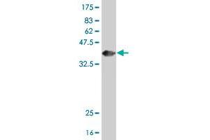 Western Blot detection against Immunogen (36. (HOXA4 antibody  (AA 181-270))