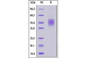 Human FGFR2 (IIIc), His Tag on  under reducing (R) condition.