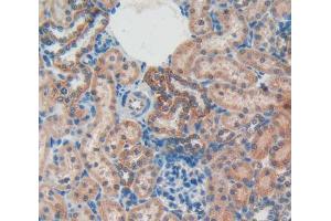 IHC-P analysis of kidney tissue, with DAB staining. (Osteocalcin antibody  (AA 11-98))