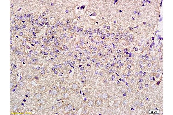 SLC29A4 antibody  (AA 401-500)