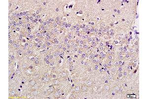 Formalin-fixed and paraffin embedded rat brain labeled with Anti-SLC29A4 Polyclonal Antibody, Unconjugated (ABIN754948) at 1:200 followed by conjugation to the secondary antibody and DAB staining (SLC29A4 antibody  (AA 401-500))