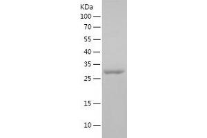 Western Blotting (WB) image for FER Tyrosine Kinase (FER) (AA 1-235) protein (His tag) (ABIN7282960) (FER Protein (AA 1-235) (His tag))
