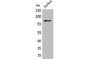 Western Blot analysis of Jurkat cells using PREP Polyclonal Antibody (PREP antibody  (N-Term))