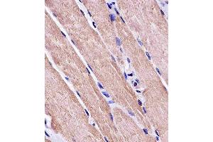 Paraformaldehyde-fixed, paraffin embedded human skeletal muscle, Antigen retrieval by boiling in sodium citrate buffer (pH6. (MYO18B antibody)