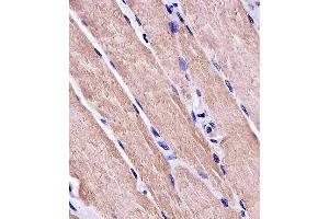 Paraformaldehyde-fixed, paraffin embedded human skeletal muscle, Antigen retrieval by boiling in sodium citrate buffer (pH6.
