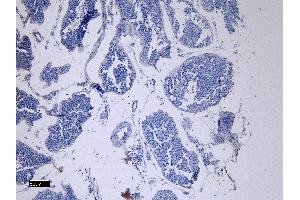 (ABIN7505816) Negative Control showing staining of paraffin embedded Human Testis, with no primary antibody. (ACE2 antibody  (N-Term))