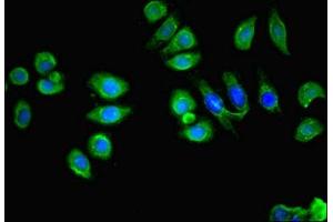 Immunofluorescent analysis of A549 cells using ABIN7158626 at dilution of 1:100 and Alexa Fluor 488-congugated AffiniPure Goat Anti-Rabbit IgG(H+L) (LY6E antibody  (AA 21-101))