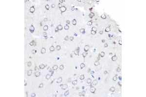 Immunohistochemistry of paraffin-embedded rat brain using [KO Validated] FGF2 Rabbit mAb (ABIN7267184) at dilution of 1:100 (40x lens). (FGF2 antibody)