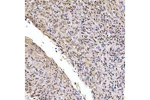 IHC analysis of SSRP1 using anti-SSRP1 antibody (ABIN7600496). (SSRP1 antibody  (AA 2-381))