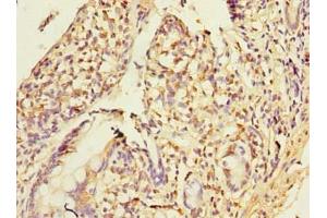 Immunohistochemistry of paraffin-embedded human small intestine tissue using ABIN7155918 at dilution of 1:100 (PLA2G16 antibody  (AA 1-132))