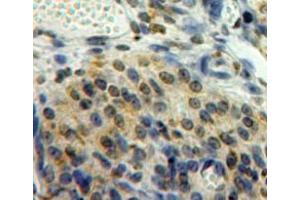 #VALUE! (EGR2 antibody  (AA 147-403))