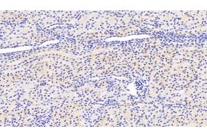 Detection of SIRT3 in Human Kidney Tissue using Polyclonal Antibody to Sirtuin 3 (SIRT3) (SIRT3 antibody  (AA 126-399))