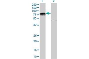 Western Blot analysis of IL22RA1 expression in transfected 293T cell line by IL22RA1 monoclonal antibody (M03), clone 6B5. (IL22 Receptor alpha 1 antibody  (AA 19-574))