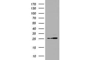 Image no. 2 for anti-Proteasome Subunit alpha 2 (PSMA2) (AA 50-234) antibody (ABIN1491567) (PSMA2 antibody  (AA 50-234))