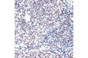 Immunohistochemistry of paraffin-embedded rat ovary using SUN2 Rabbit mAb (ABIN7270135) at dilution of 1:100 (40x lens). (SUN2 antibody)