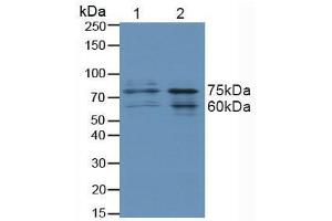 Western blot analysis of (1) Human HeLa cells and (2) Human 293T Cells. (FOXO3 antibody  (AA 369-633))
