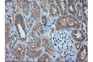 Immunohistochemical staining of paraffin-embedded liver tissue using anti-SERPINA1mouse monoclonal antibody. (SERPINA1 antibody)