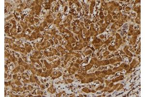 ABIN6269334 at 1/100 staining Human liver tissue by IHC-P. (BCL2L1 antibody  (N-Term))
