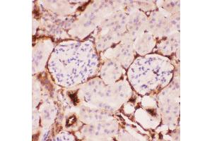 Anti-P Glycoprotein Picoband antibody,  IHC(P): Mouse Kidney Tissue (ABCB1 antibody  (Middle Region))