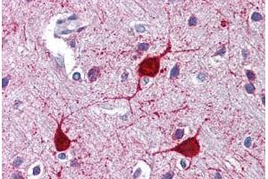 Human Brain, Cortex: Formalin-Fixed, Paraffin-Embedded (FFPE) (LYVE1 antibody  (N-Term))