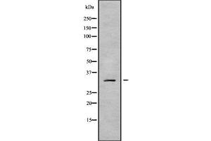 Western blot analysis of MRPL19 using Jurkat whole cell lysates (MRPL19 antibody  (Internal Region))