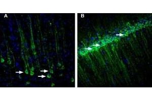 Expression of RAMP1 in rat brain - Immunohistochemical staining of rat free-floating frozen section using Anti-RAMP1 (extracellular) Antibody (ABIN7043595, ABIN7045219 and ABIN7045220). (RAMP1 antibody  (Extracellular, N-Term))