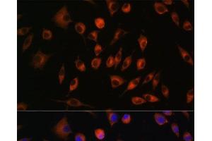 Immunofluorescence analysis of L929 cells using TRIM4 Polyclonal Antibody at dilution of 1:100. (TRIM4 antibody)