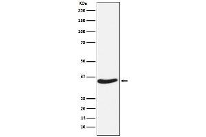 Western blot analysis of EXOSC7 expression in HeLa cell lysate.