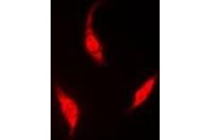 Immunofluorescent analysis of HIWI2 staining in A549 cells. (PIWIL4 antibody)