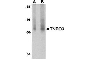 Western blot analysis of TNPO3 in rat liver tissue lysate with TNPO3 antibody at (A) 1 and (B) 2 μg/ml.
