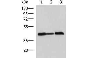 Western blot analysis of A549 Hela and HepG2 cell lysates using PDHA1 Polyclonal Antibody at dilution of 1:750 (PDHA1 antibody)