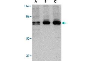 Western blot analysis of PTK7 in (A) human, (B) mouse and (C) rat colon tissue lysate with PTK7 polyclonal antibody  at 1 ug/mL . (PTK7 antibody  (N-Term))