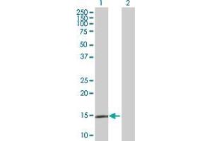 Western Blot analysis of LAMA4 expression in transfected 293T cell line by LAMA4 MaxPab polyclonal antibody. (LAMa4 antibody  (AA 1-120))