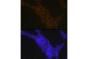 Immunofluorescence analysis of Jurkat cells using LSP1 Rabbit mAb (ABIN7268319) at dilution of 1:100 (40x lens). (LSP1 antibody)
