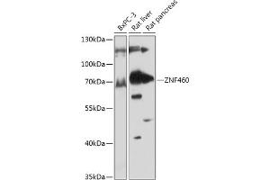 Western blot analysis of extracts of various cell lines, using ZNF460 antibody (ABIN7271490) at 1:1000 dilution.