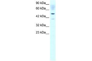 ACAT2 antibody used at 1 ug/ml to detect target protein. (ACAT2 antibody)