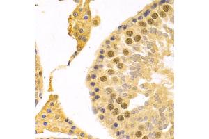 Immunohistochemistry of paraffin-embedded rat testis using RFC4 Antibody (ABIN5973195) at dilution of 1/100 (40x lens). (RFC4 antibody)