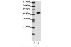 Image no. 1 for anti-Transcriptional Adaptor 3 (TADA3) (N-Term) antibody (ABIN6736139)