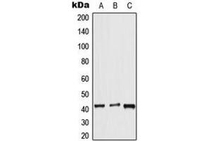 Western blot analysis of APJ expression in HeLa (A), mouse lung (B), rat liver (C) whole cell lysates. (Apelin Receptor antibody  (Center))