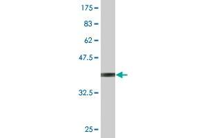 Western Blot detection against Immunogen (36. (CAMKK1 antibody  (AA 2-100))