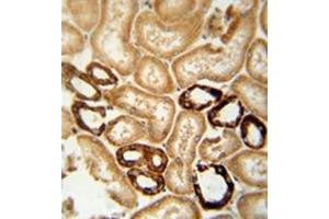 Immunohistochemistry analysis in formalin fixed and paraffin embedded human lymph node reacted with LRRC33 Antibody (C-term) followed which was peroxidase conjugated to the secondary antibody and followed by DAB staining.