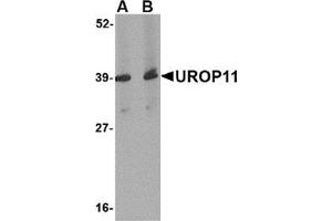 Western blot analysis of UROP11 in mouse spleen tissue lysate with this product at (A) 1 and (B) 2 μg/ml. (APBA1 antibody  (Center))