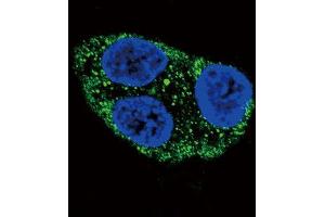 Immunofluorescence (IF) image for anti-Tyrosinase (TYR) antibody (ABIN3003157)