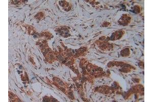 Immunohistochemistry (IHC) image for anti-Placental Alkaline Phosphatase (ALPP) (AA 162-312) antibody (ABIN7432097)